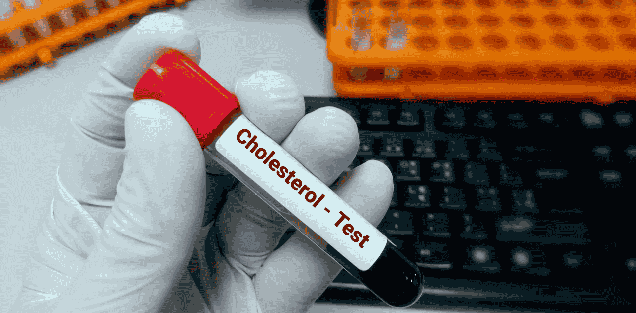 Statins: The Most Common Cholesterol-Lowering Drug