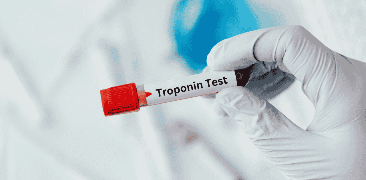 The Role of Troponin and BNP in Diagnosing Heart Disease