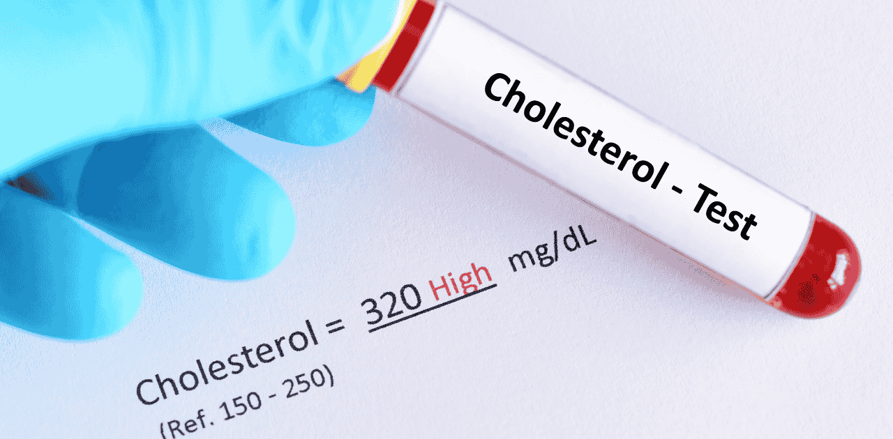 What Does Your Cholesterol Test Reveal About Heart Health?