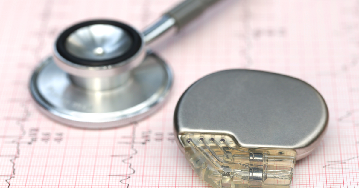 Pacemakers: What They Do and Who Needs One
