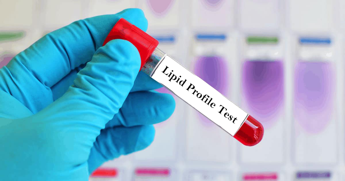 Lipid Profile: A Cardiologist Explains