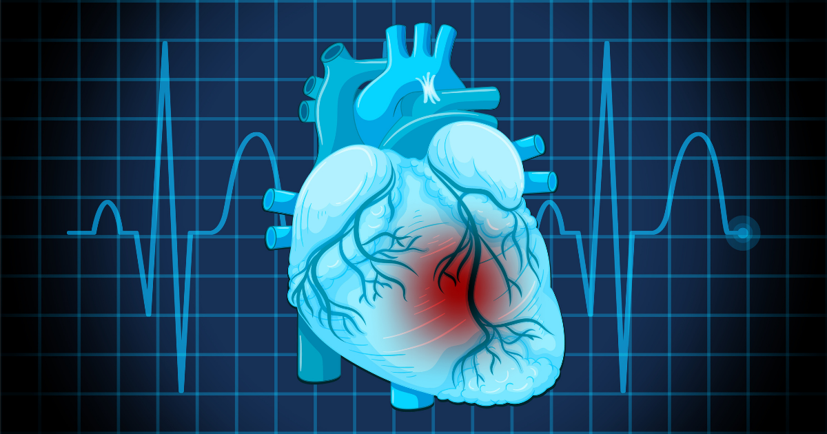 How 3D Echocardiography is Transforming Cardiac Imaging