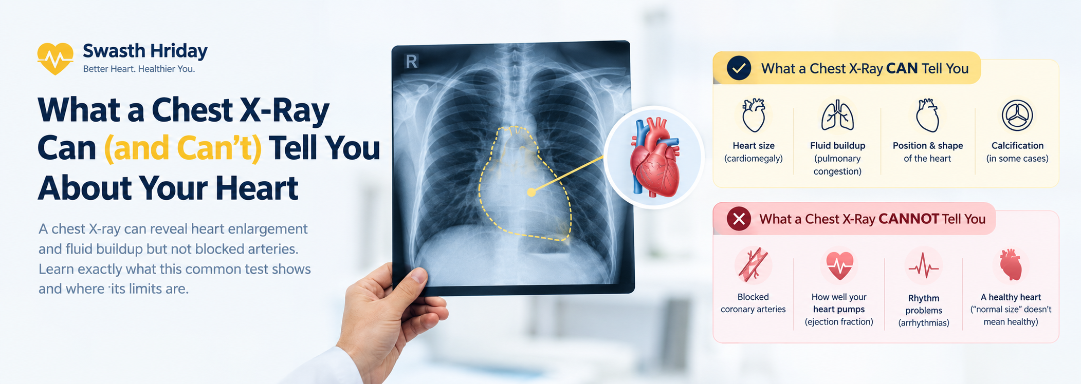 What a Chest X-Ray Can (and Can't) Tell You About Your Heart
